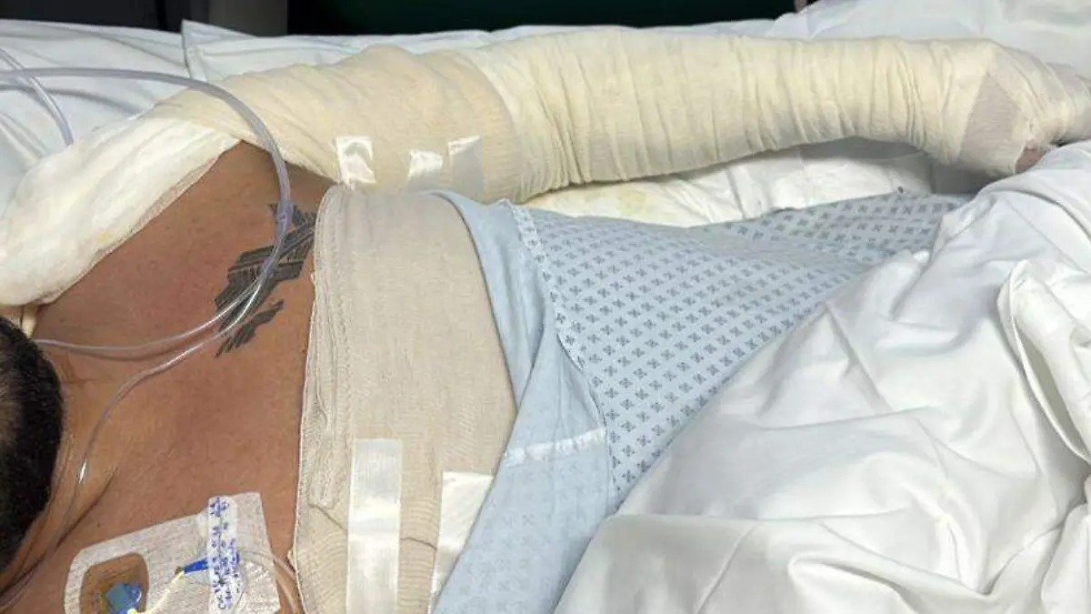 HERMANOS HERIDOS EN EXPLOSIÓN DE GAS EN AGUA SANTA REQUIEREN APOYO PARA TRATAMIENTO DE QUEMADURAS